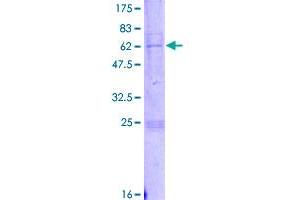 Image no. 1 for Prenyl (Decaprenyl) Diphosphate Synthase, Subunit 1 (PDSS1) (AA 1-306) protein (GST tag) (ABIN7540273)