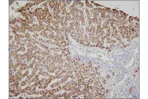 Human liver tissue was initrocelluloseubated with anti-human Ak3 (1:100) for 2 hours at room temperature.