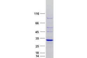 Validation with Western Blot