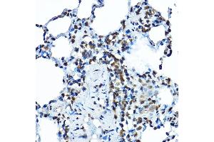 Immunohistochemistry of paraffin-embedded rat lung using BOP1 Rabbit pAb (ABIN7265887) at dilution of 1:100 (40x lens). (BOP1 anticorps  (AA 600-680))
