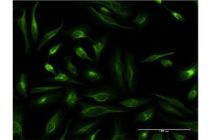 Immunofluorescence of monoclonal antibody to TAGLN on HeLa cell.