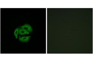Immunofluorescence analysis of A549 cells, using Cytochrome P450 39A1 Antibody.