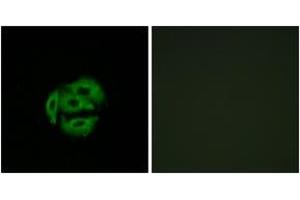 Immunofluorescence analysis of A549 cells, using Cytochrome P450 39A1 Antibody. (CYP39A1 anticorps  (AA 361-410))