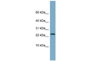 WB Suggested Anti-LRRC20 Antibody Titration: 0.