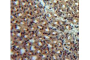Used in DAB staining on fromalin fixed paraffin-embedded Kidney tissue (IL12B anticorps  (AA 35-302))