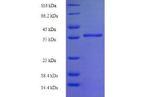 SDS-PAGE (SDS) image for Chromosome 11 Open Reading Frame 73 (C11orf73) (AA 1-197), (full length) protein (His-SUMO Tag) (ABIN5711383)