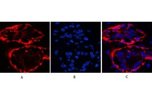Immunofluorescence analysis of human breast tissue. (KRT17 anticorps)