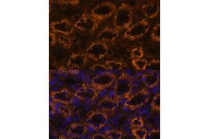 Immunofluorescence analysis of rat kidney using SLC7 antibody (ABIN6130697, ABIN6148048, ABIN6148049 and ABIN6216625) at dilution of 1:100. (SLC7A9 anticorps  (AA 1-100))