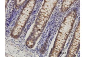 Immunoperoxidase of monoclonal antibody to HADHSC on formalin-fixed paraffin-embedded human colon.