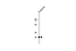 Anti-CFD Antibody (N-term) at 1:2000 dilution + human plasma lysate Lysates/proteins at 20 μg per lane. (Adipsin anticorps  (N-Term))