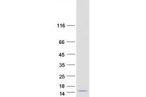 Validation with Western Blot