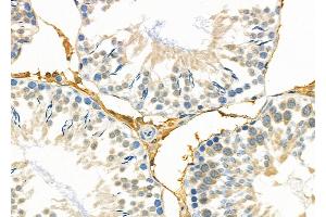 ABIN6263362 and ABIN6279017 at 1/100 staining Rat testis tissue by IHC-P.