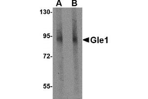 Western Blotting (WB) image for anti-GLE1 RNA Export Mediator (GLE1) (C-Term) antibody (ABIN1030413) (GLE1 anticorps  (C-Term))