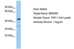 Image no. 1 for anti-Bradykinin Receptor B1 (BDKRB1) (AA 230-279) antibody (ABIN6749995) (BDKRB1 anticorps  (AA 230-279))