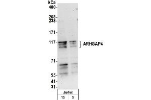 anti-rho GTPase Activating Protein 4 (ARHGAP4) (AA 700-750) antibody