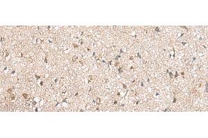 Immunohistochemistry of paraffin-embedded Human brain tissue using RPL23A Polyclonal Antibody at dilution of 1:50(x200)