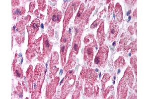 Anti-SCNN1B antibody IHC of human heart.