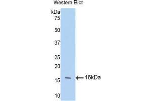 Western blot analysis of the recombinant protein. (FGF13 anticorps  (AA 108-227))