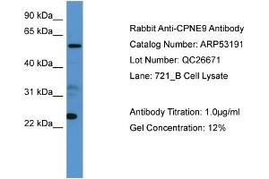 WB Suggested Anti-CPNE9  Antibody Titration: 0. (CPNE9 anticorps  (C-Term))