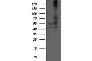 Image no. 1 for anti-Dihydrolipoamide Dehydrogenase (DLD) antibody (ABIN1497850) (DLD anticorps)