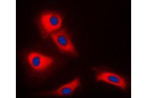 Immunofluorescent analysis of TRAF3 staining in HeLa cells. (TRAF3 anticorps  (Center))