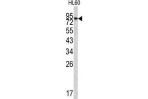 Western Blotting (WB) image for anti-Carboxypeptidase X (M14 Family), Member 2 (CPXM2) antibody (ABIN3002685) (CPXM2 anticorps)