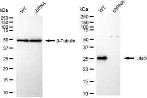 Western blotting analysis using UNG antibody (ABIN7800773).