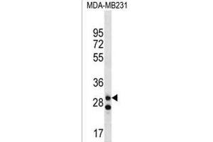 LRRC3C Antibody (C-term) (ABIN1536905 and ABIN2850344) western blot analysis in MDA-M cell line lysates (35 μg/lane). (LRRC3C anticorps  (C-Term))
