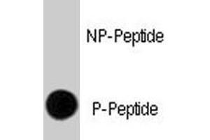 Dot blot analysis of ERBB2 (phospho Y1248) polyclonal antibody  on nitrocellulose membrane. (ErbB2/Her2 anticorps  (pTyr1248))