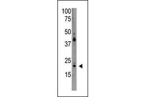 The anti-PD Antibody (C-term) (ABIN390190 and ABIN2840681) is used in Western blot to detect PD in HL60 lysate.