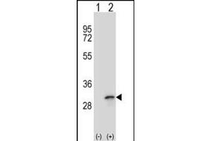 Western blot analysis of FHL1 (arrow) using rabbit polyclonal FHL1 Antibody (C-term) (ABIN390835 and ABIN2841061). (FHL1 anticorps  (C-Term))