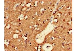Immunohistochemistry of paraffin-embedded human brain tissue using ABIN7161314 at dilution of 1:100
