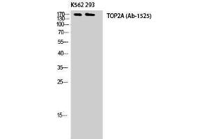 Western Blotting (WB) image for anti-Topo IIalpha (Tyr174) antibody (ABIN3177762) (Topo IIalpha (Tyr174) anticorps)