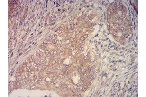 anti-Histone-lysine N-methyltransferase 2C (KMT2C) (AA 1-205) antibody