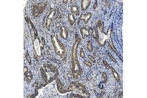 IHC analysis of SMAD2 using anti-SMAD2 antibody (ABIN7602542). (SMAD2 anticorps  (AA 83-264))