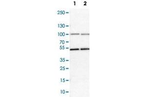 Western Blot analysis of Lane 1: NIH-3T3 cell lysate (mouse embryonic fibroblast cells) and Lane 2: NBT-II cell lysate (Wistar rat bladder tumor cells) with MCM7 polyclonal antibody . (MCM7 anticorps)