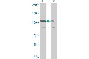 Western Blot analysis of KIT expression in transfected 293T cell line by KIT monoclonal antibody (M10), clone x1. (KIT anticorps  (AA 41-140))