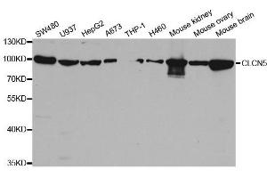 Western blot analysis of extracts of various cell lines, using CLCN5 antibody. (Chloride Channel 5 anticorps  (AA 637-816))