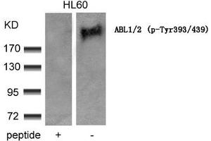 Western blot analysis of extracts from HL60 cells using ABL1/2(phospho-Tyr393/439) Antibody and the same antibody preincubated with blocking peptide.