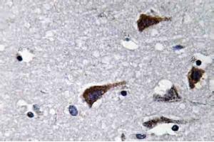 Immunohistochemistry analysis of Cathepsin B Antibody in Paraffin-Embedded Human brain tissue. (Cathepsin B anticorps)