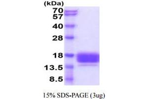 SDS-PAGE (SDS) image for Carcinoembryonic Antigen-Related Cell Adhesion Molecule 3 (CEACAM3) (AA 35-155) protein (His tag) (ABIN5854924)