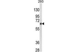 Western blot analysis of CYP3A5 Antibody (Center) in 293 cell line lysates (35ug/lane).