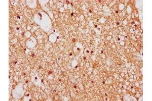IHC image of ABIN7176211 diluted at 1:400 and staining in paraffin-embedded human brain tissue performed on a Leica BondTM system. (ZNF282 anticorps  (AA 240-384))