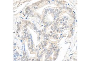 Immunohistochemistry (IHC) image for anti-SWI/SNF Related, Matrix Associated, Actin Dependent Regulator of Chromatin, Subfamily B, Member 1 (SMARCB1) (AA 75-125) antibody (ABIN7453587)