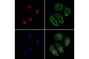 ABIN6263144 and ABIN6277139 staining Hela cells by IF/ICC. (MAX anticorps  (N-Term))