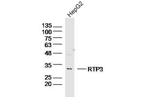 Human HepG2 lysates probed with RTP3 Polyclonal Antibody, Unconjugated  at 1:300 dilution and 4˚C overnight incubation. (RTP3 anticorps  (AA 21-120))