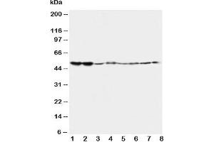 Western blot testing of 5HT2A Receptor antibody and Lane 1:  rat brain;  2: rat brain;  3: mouse brain;  4: mouse brain and human samples  5: U87;  6: SMMC-7721;  7: HT1080;  8: COLO320