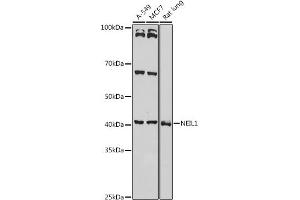 Western blot analysis of extracts of various cell lines, using NEIL1 antibody (ABIN6130579, ABIN6144514, ABIN6144515 and ABIN6221523) at 1:1000 dilution. (NEIL1 anticorps  (AA 187-476))