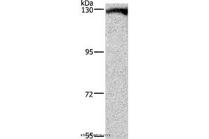 Western blot analysis of Human testis tissue, using DAAM1 Polyclonal Antibody at dilution of 1:400 (DAAM1 anticorps)