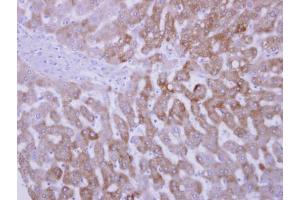 IHC-P Image FMO3 antibody [N2C2], Internal detects FMO3 protein at cytosol on human normal liver by immunohistochemical analysis. (FMO3 anticorps)